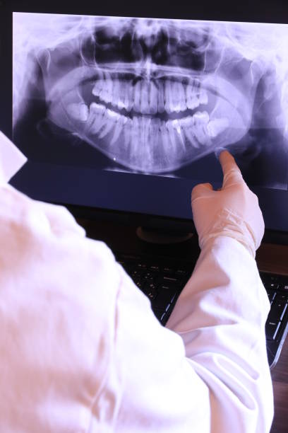 Best Emergency Wisdom Teeth Removal in Papillion, NE