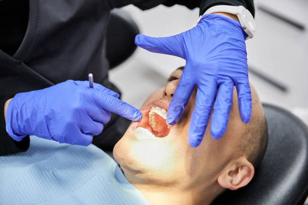 Best Emergency Root Canal Treatment in Papillion, NE