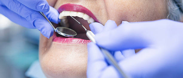 Best Emergency Denture Repair in Papillion, NE